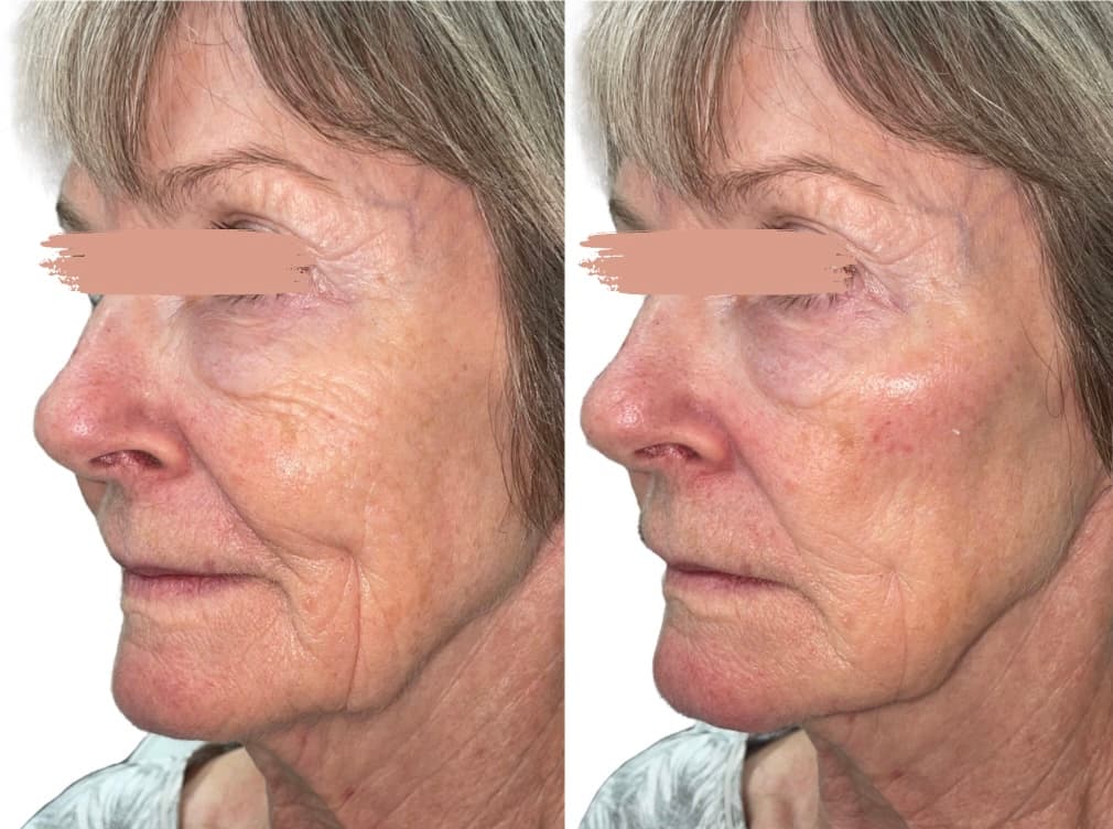 Dermacenter Medical Spa