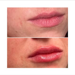 Dermacenter Medical Spa photo 9