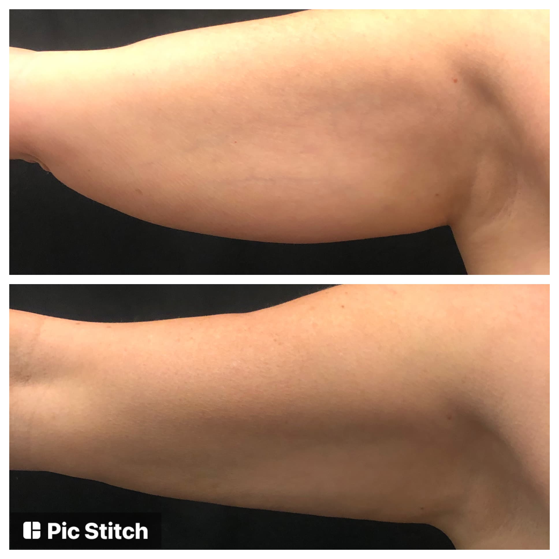 The Sculpting Spa Boise photo 6