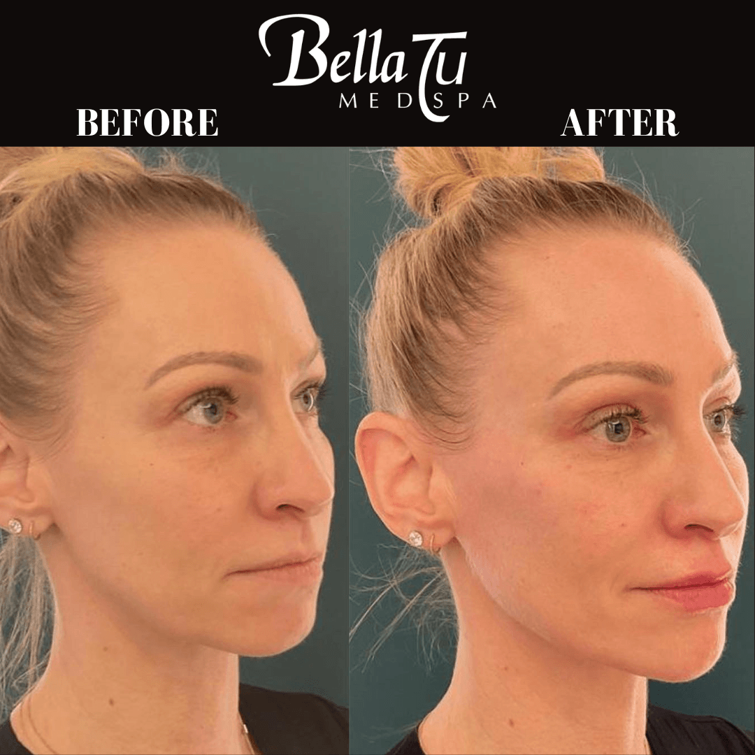 Bella Tu Med Spa photo 11