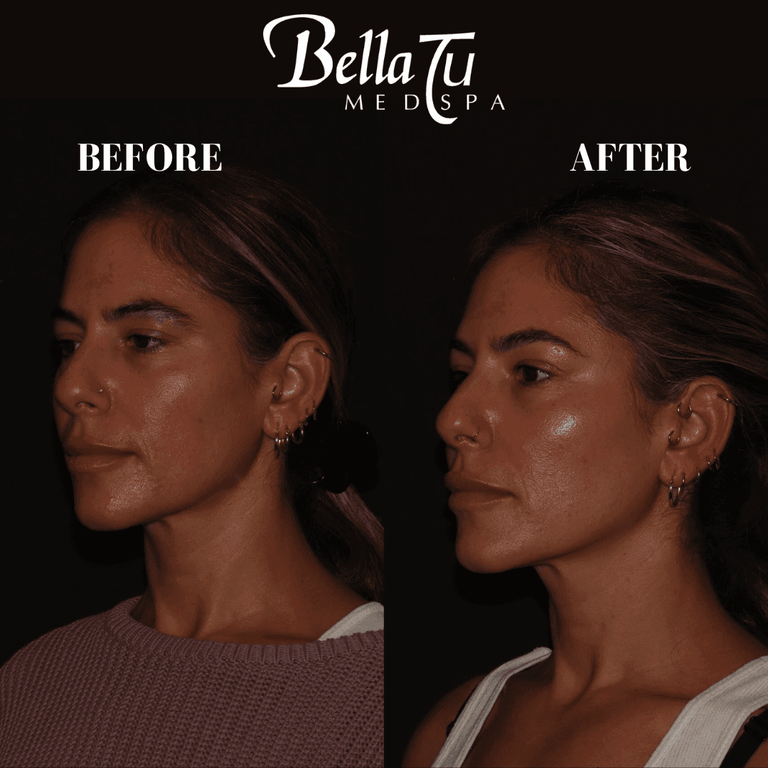Bella Tu Med Spa photo 8