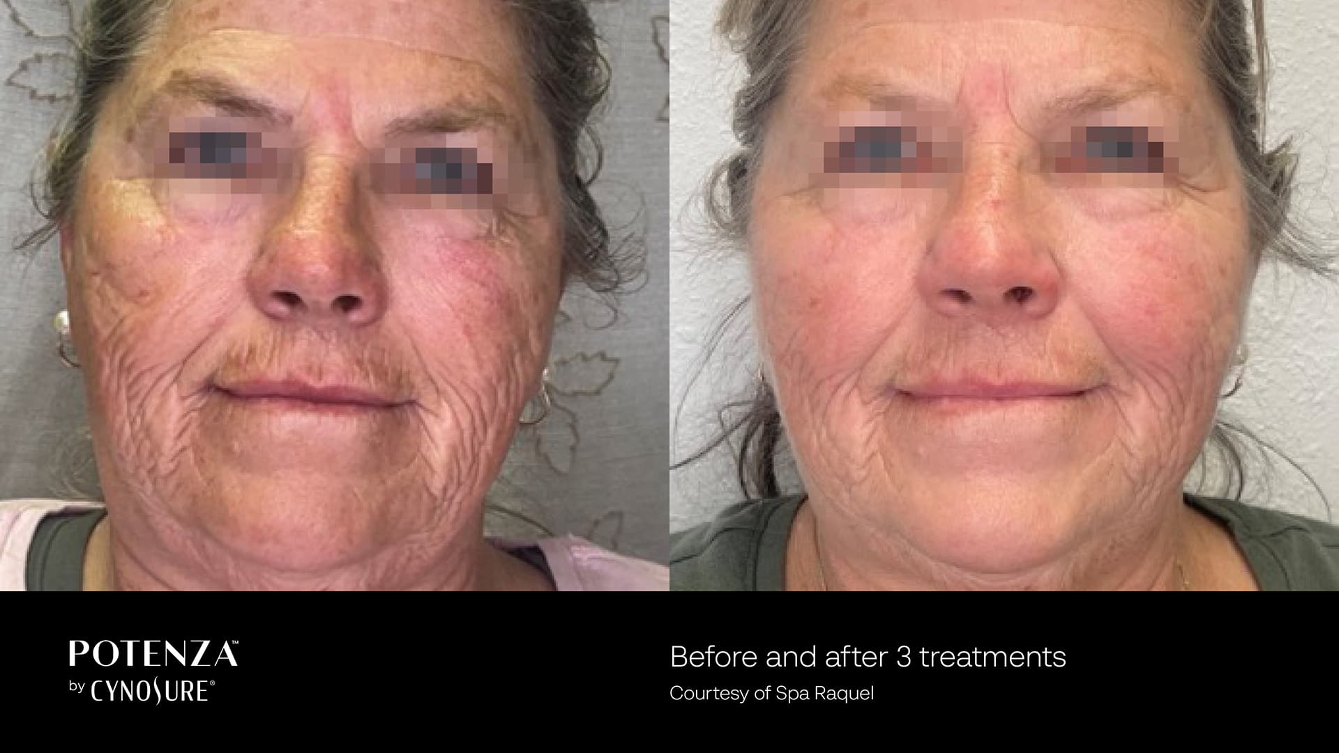 Discovery Skinworks photo 39