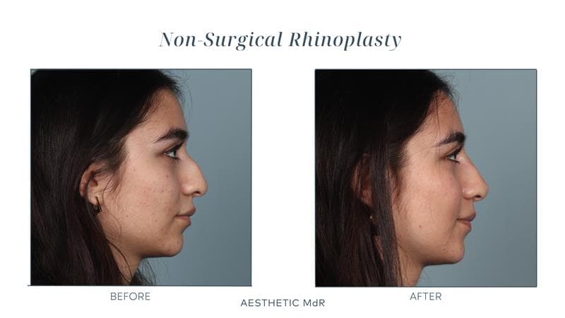 Aesthetic MdR photo 18