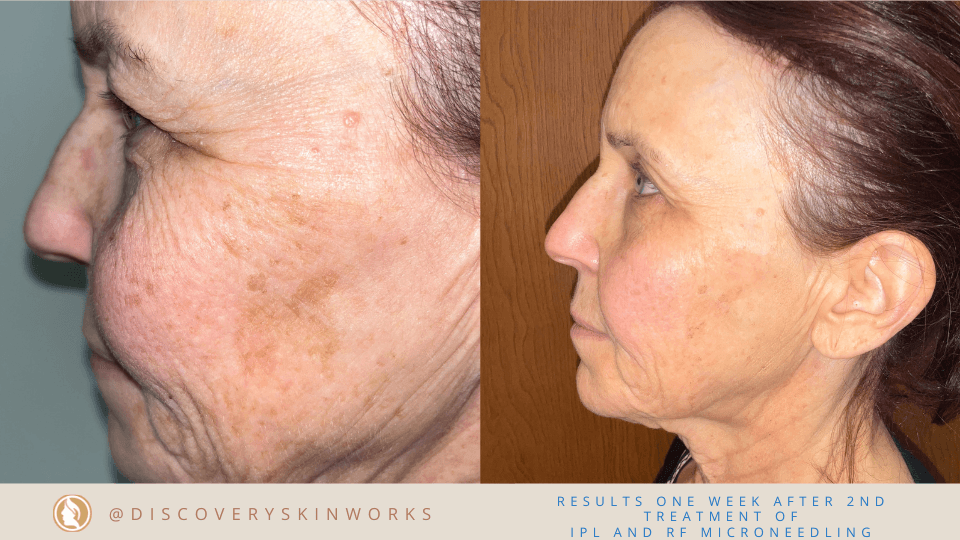Discovery Skinworks