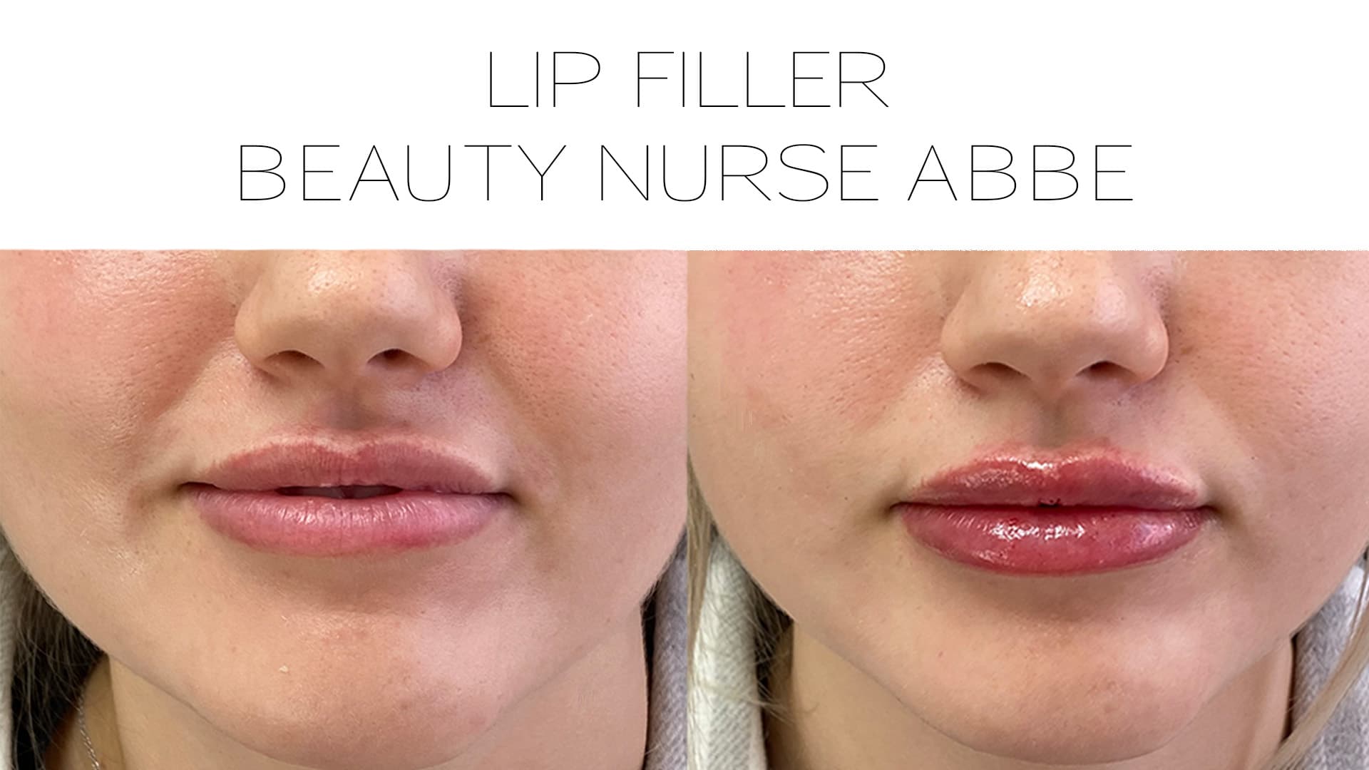 Beauty Nurse Abbe photo 29