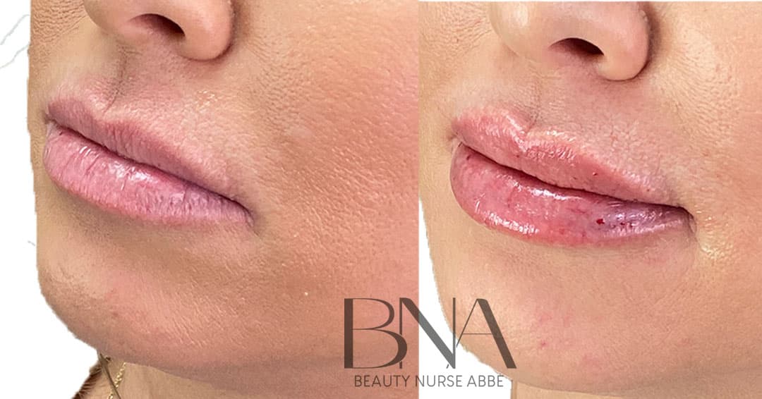 Beauty Nurse Abbe photo 26