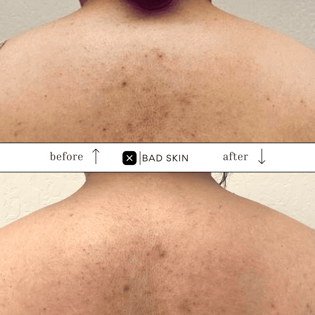 Bad Skin photo 4