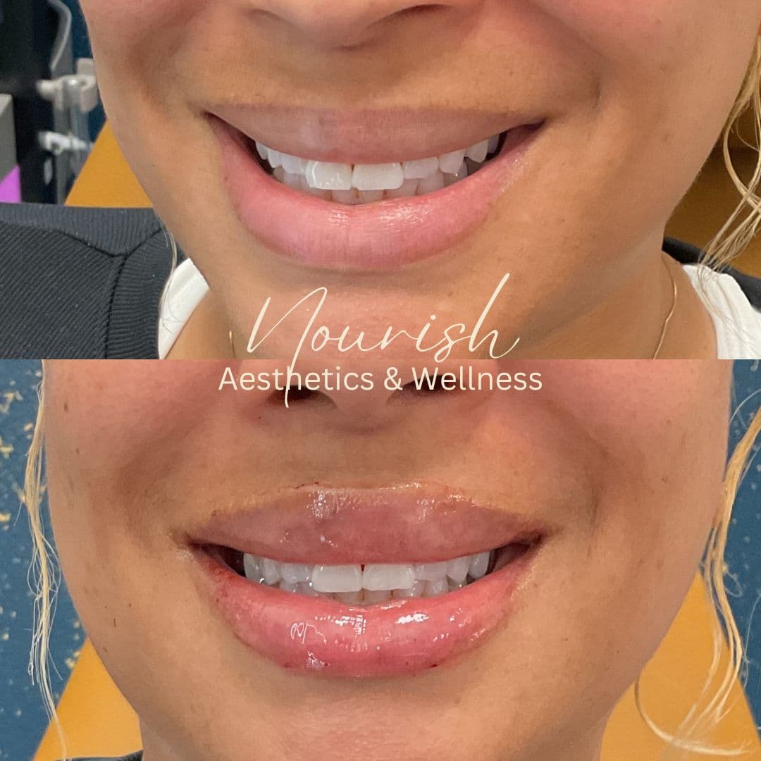 Nourish Aesthetics & Wellness photo 10