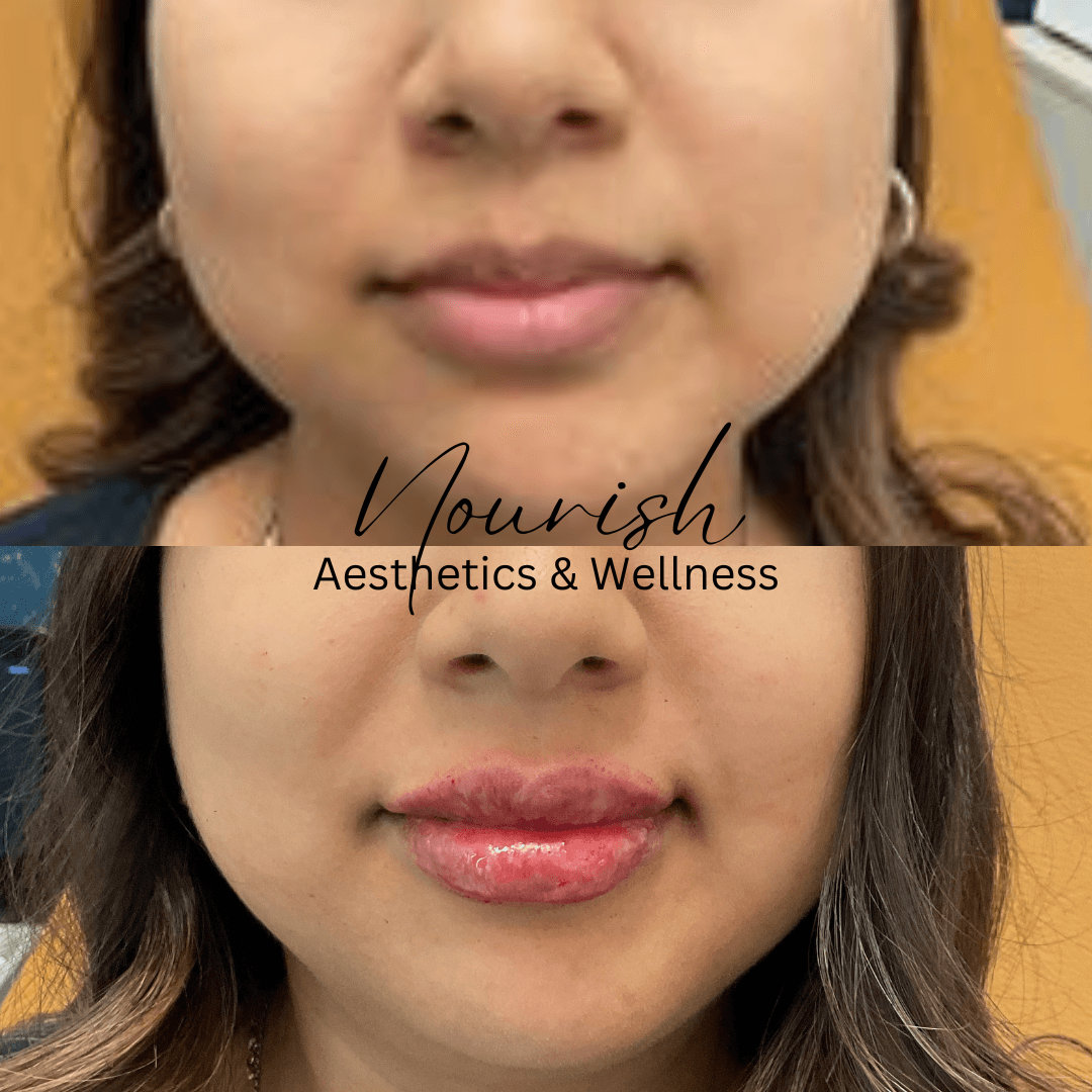 Nourish Aesthetics & Wellness photo 22