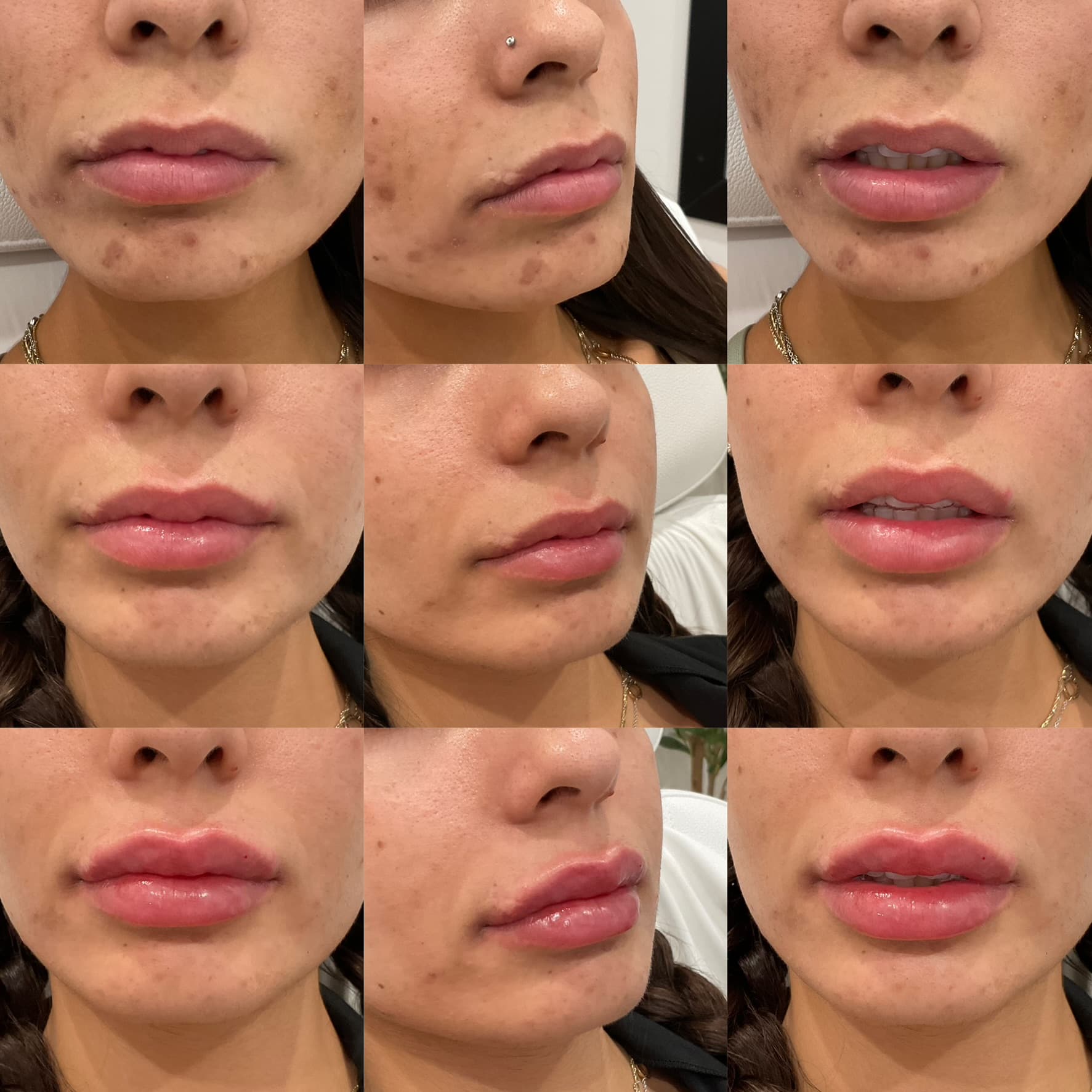 Beverly Hills Aesthetic Medics photo 5