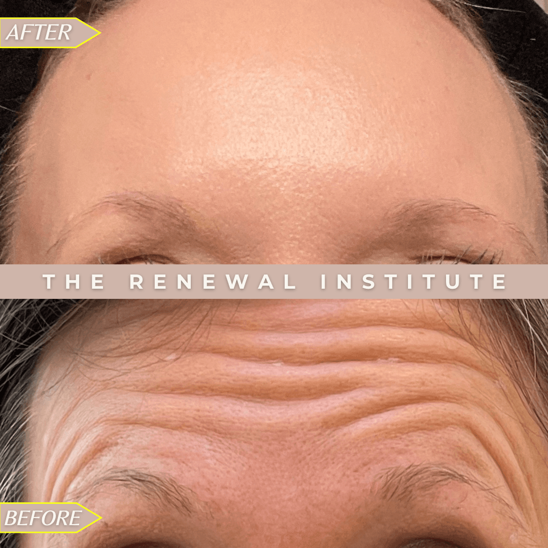 The Renewal Institute