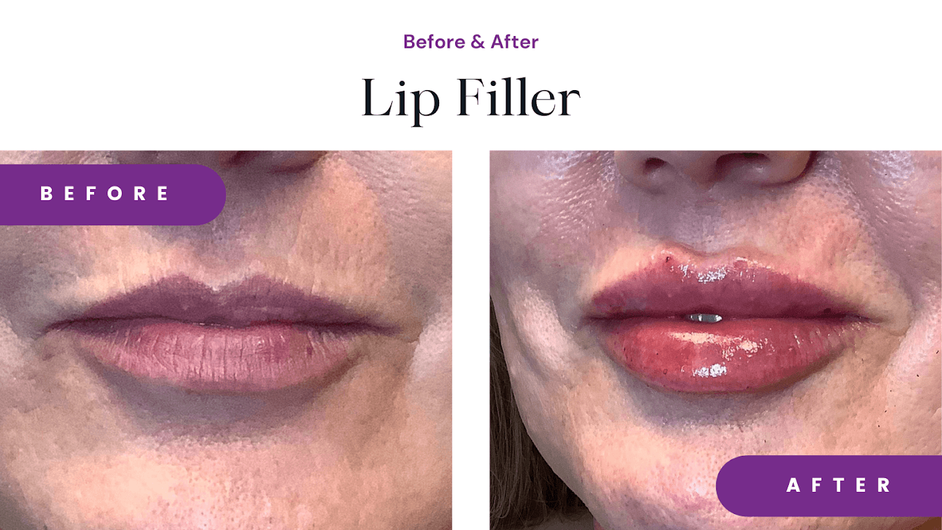 Abloom Medical Spa photo 18